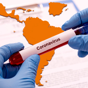 Comunicado conjunto de los organismos iberoamericanos ante la pandemia del COVID19